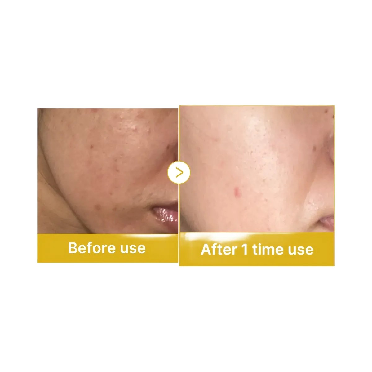 Medicube Kojic Acid Turmeric Overnight Wrapping Mask - HypeFly India View 6