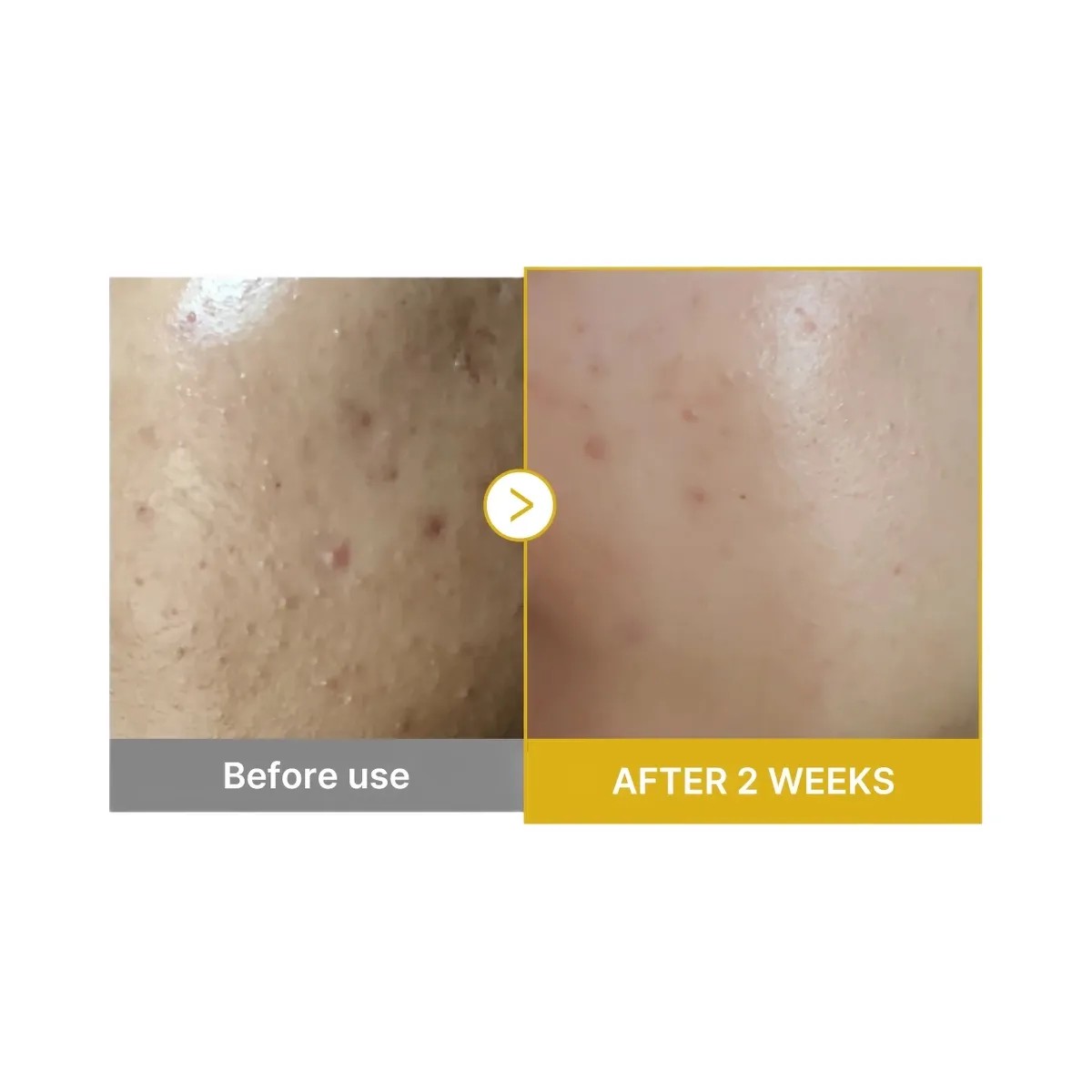 Medicube Kojic Acid Turmeric Peel Shot - HypeFly India View 3