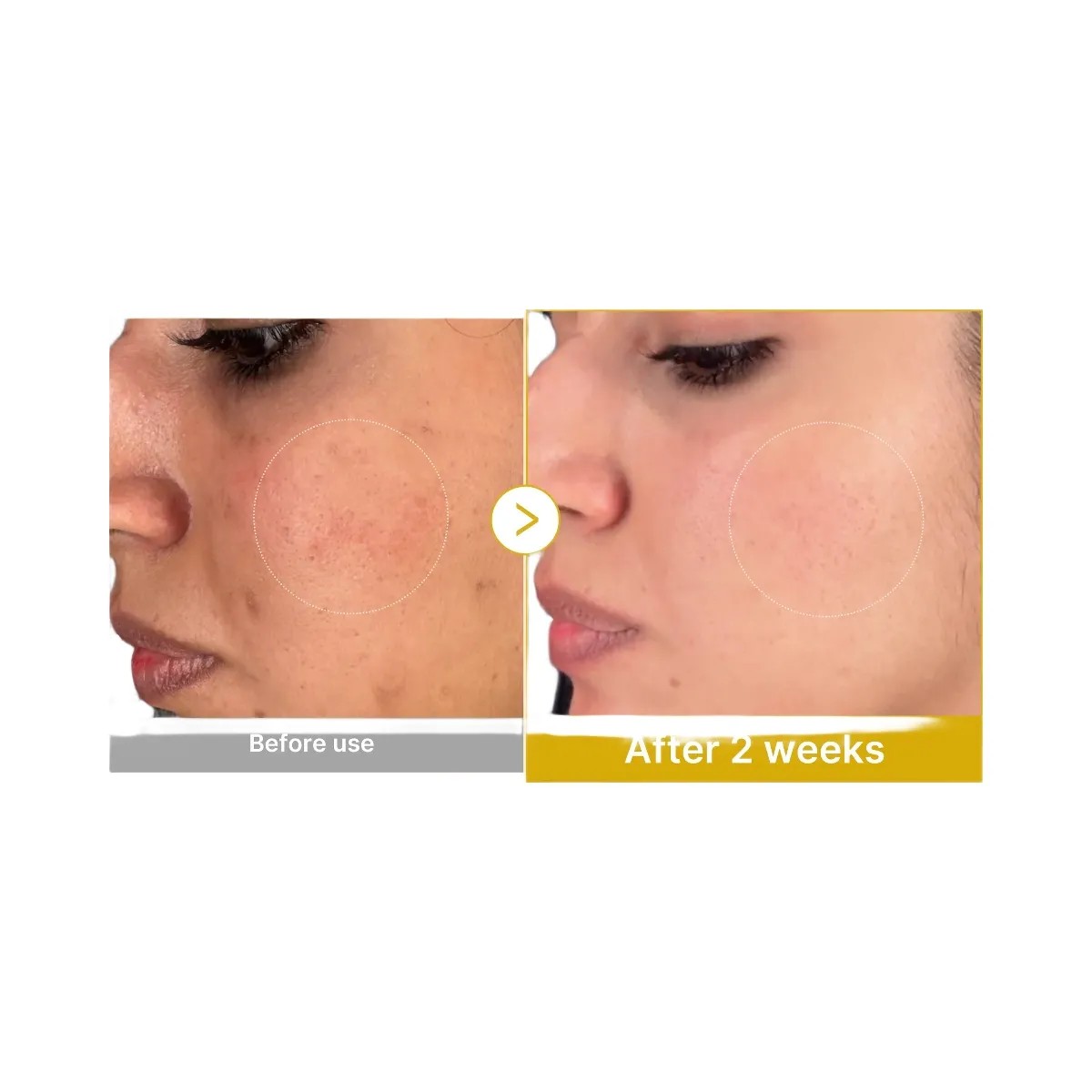 Medicube Kojic Acid Turmeric Toner - HypeFly India View 4
