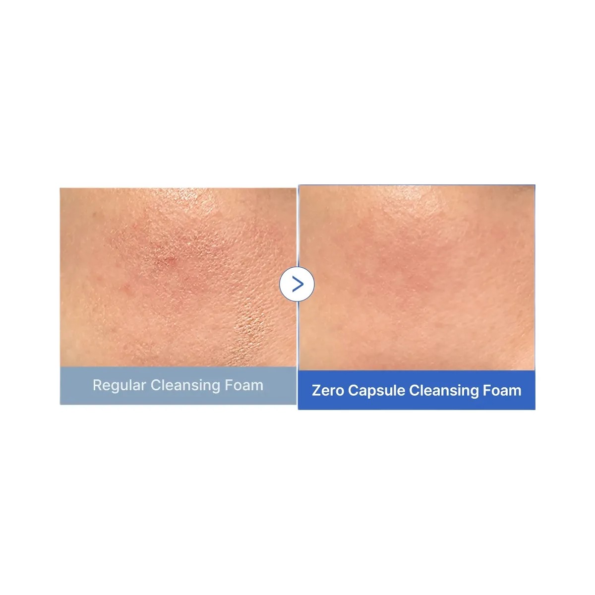 Medicube Zero Pore Capsule Cleansing Foam - HypeFly India View 3