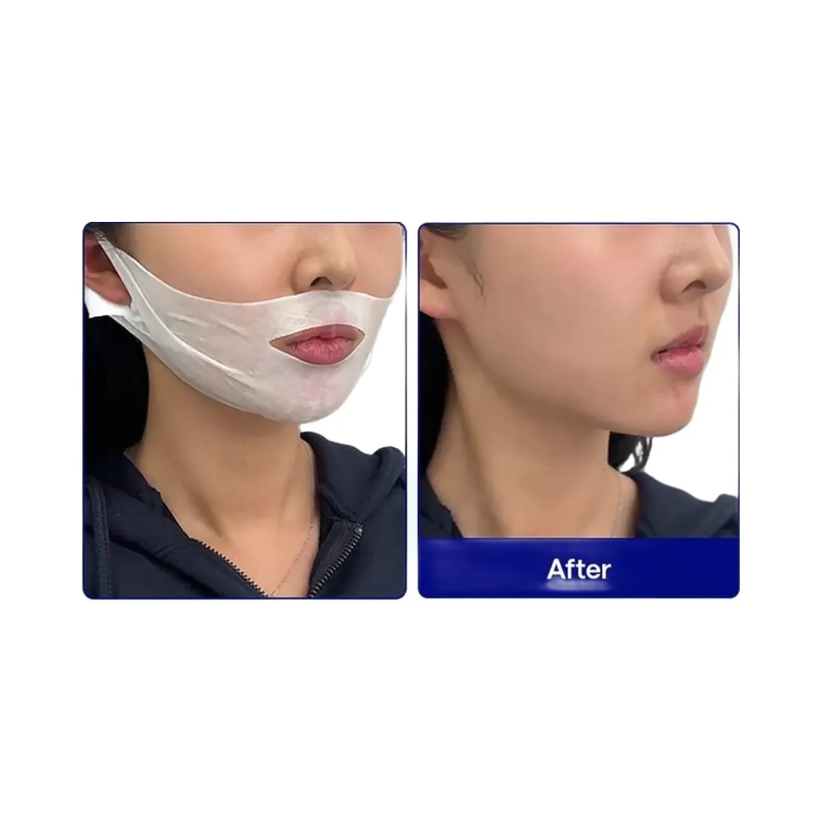 MEDIHEAL V.T.R Stretching Patch - HypeFly India View 5