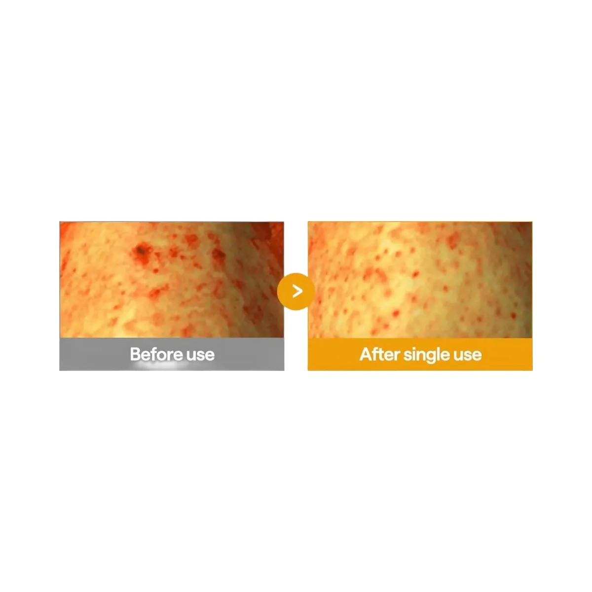 MEDIHEAL Vitamin C Pore Toning Cleanser - HypeFly India View 6