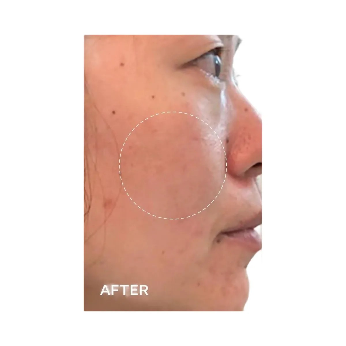 PEACH & LILY Glass Skin Refining Serum - HypeFly India View 5
