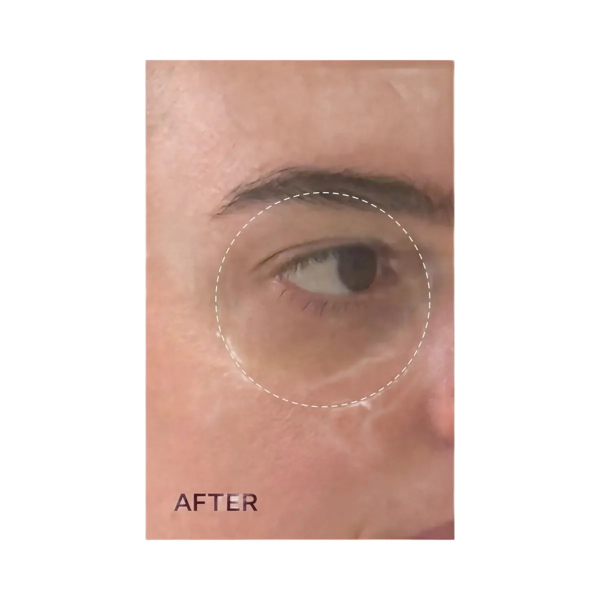 PEACH & LILY Pure Radiance Brightening Eye Cream - HypeFly India View 5