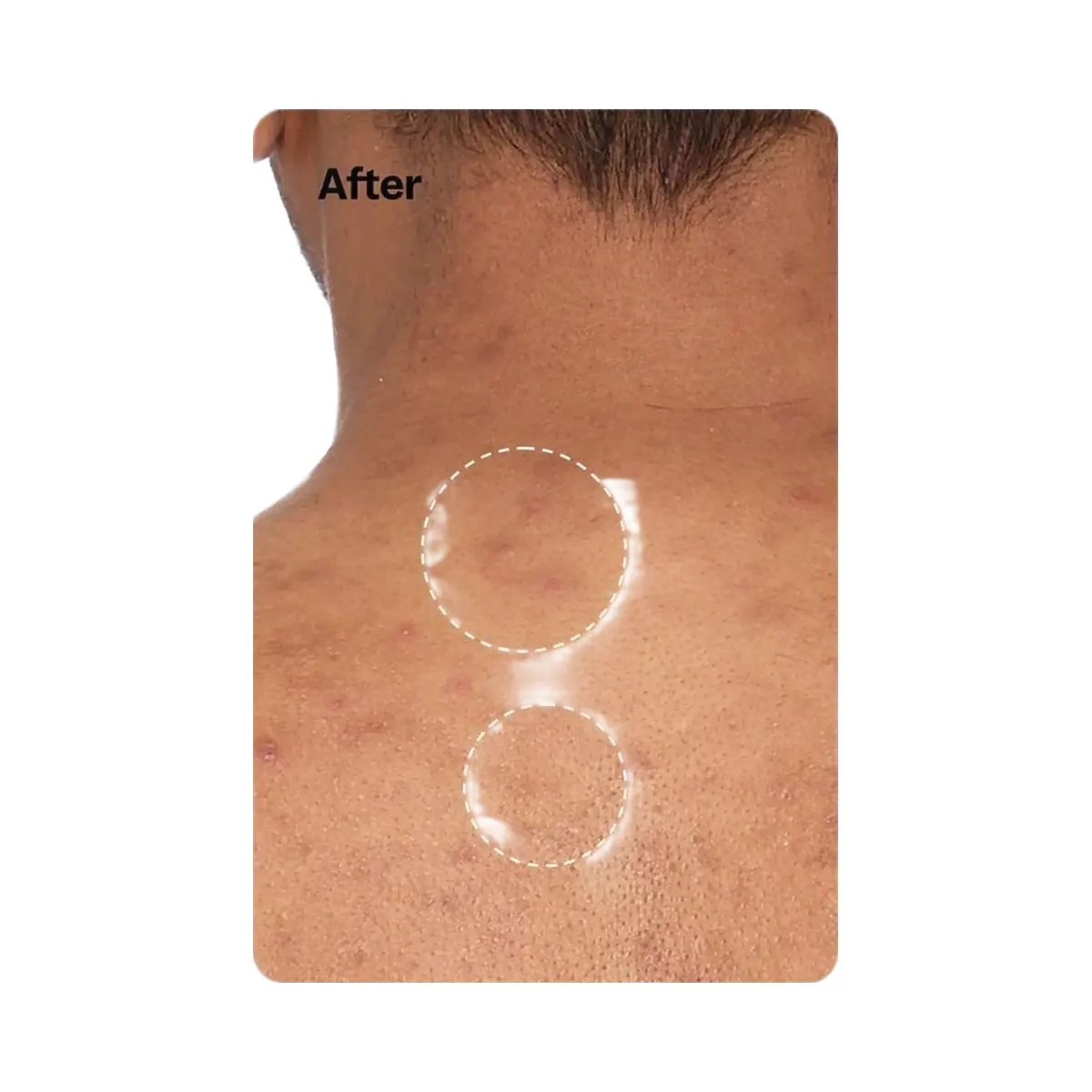 Peach Slices Breakout Banisher Body Wash - HypeFly India View 5
