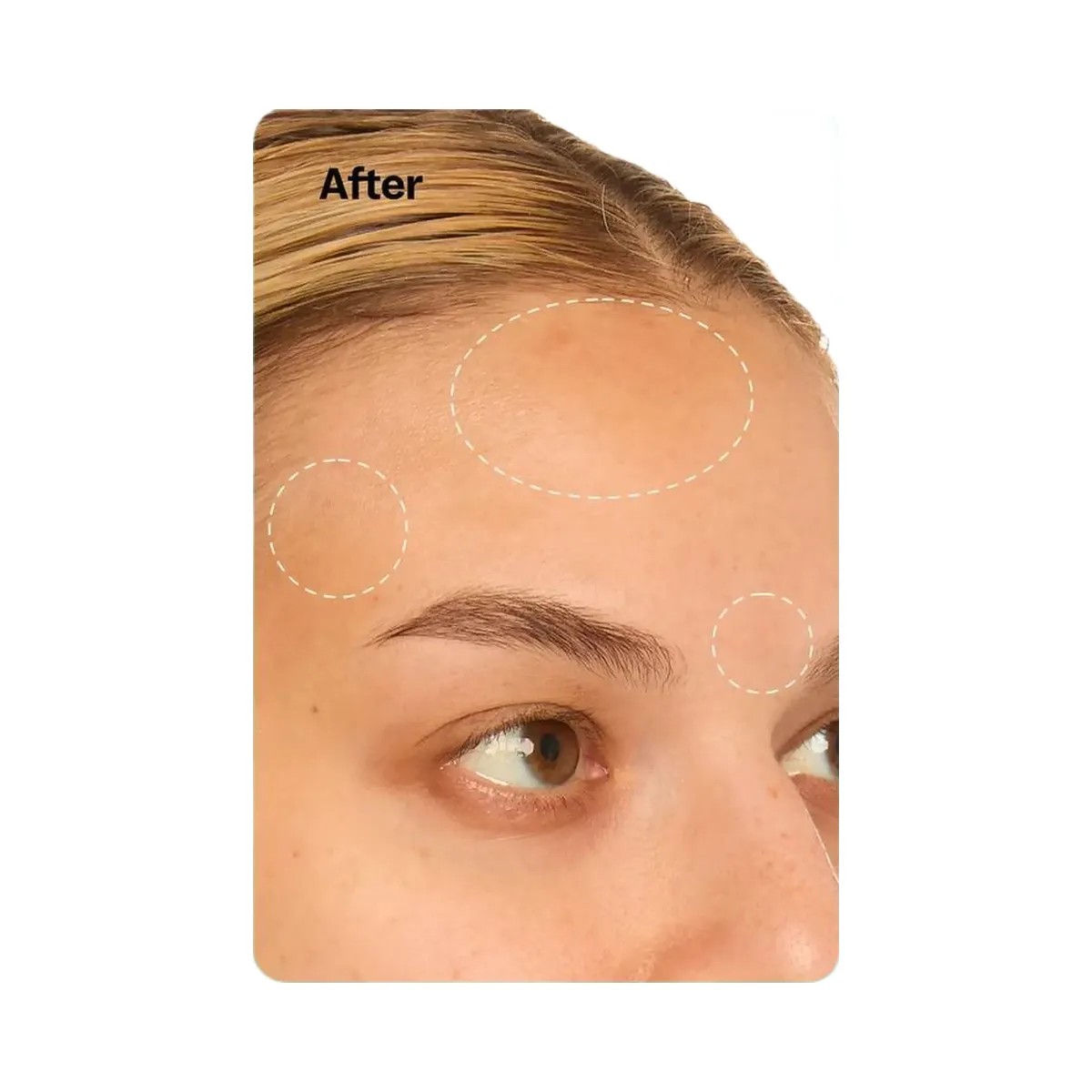 Peach Slices Snail Rescue Intensive Serum - HypeFly India View 5