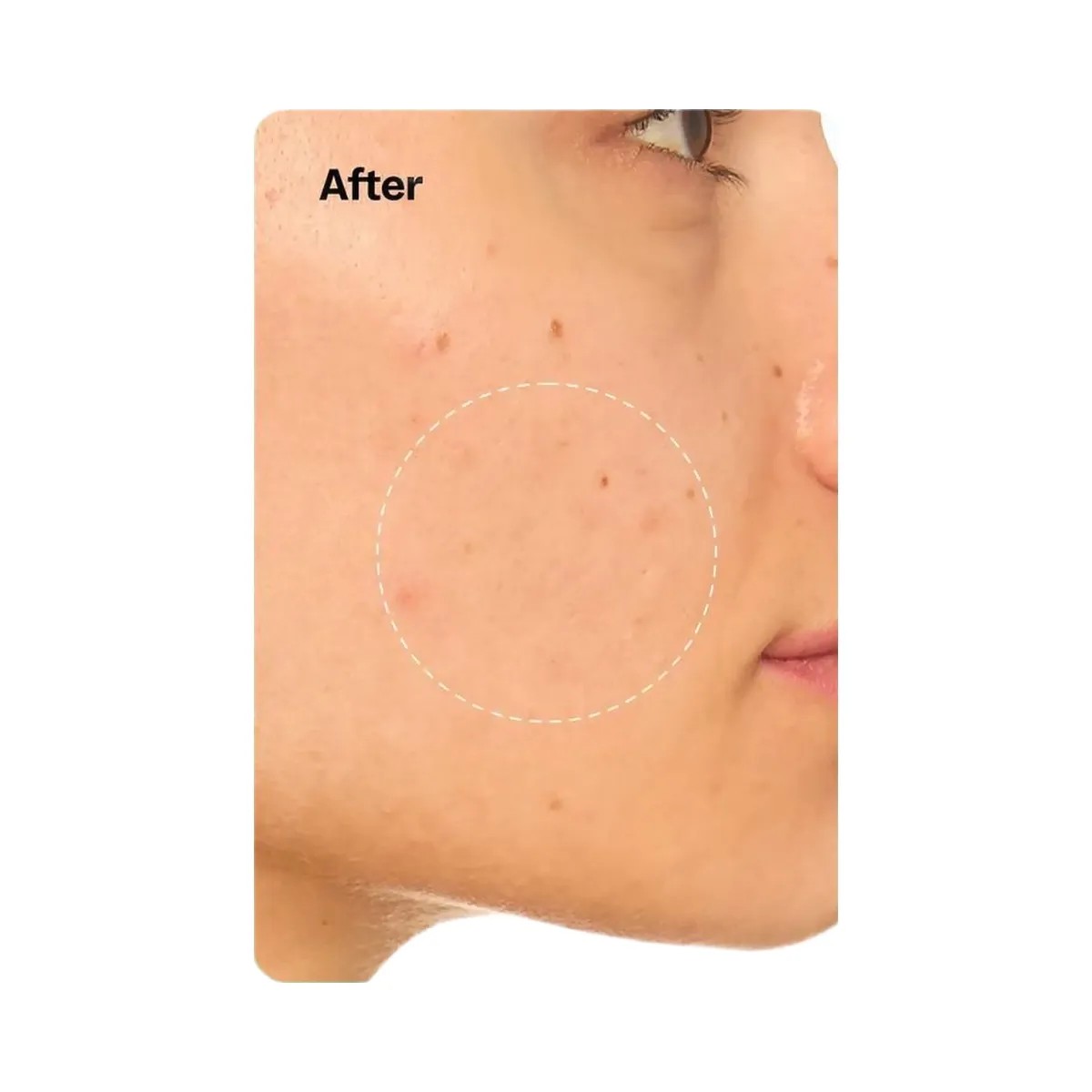 Peach Slices Snail Rescue Intensive Wash-Off Jelly Mask - HypeFly India View 6