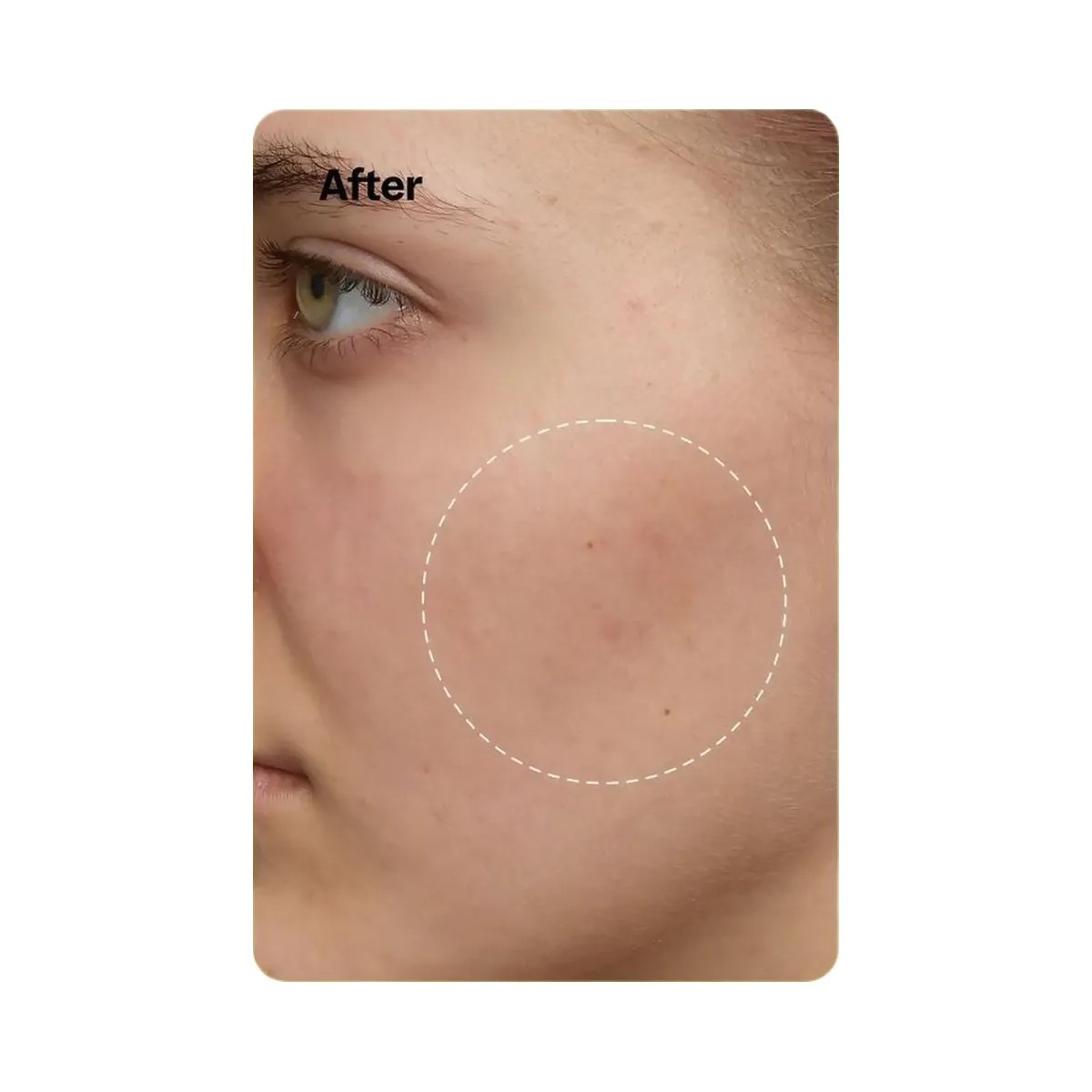Peach Slices Super Fade Discoloration Moisturizer - HypeFly India View 5