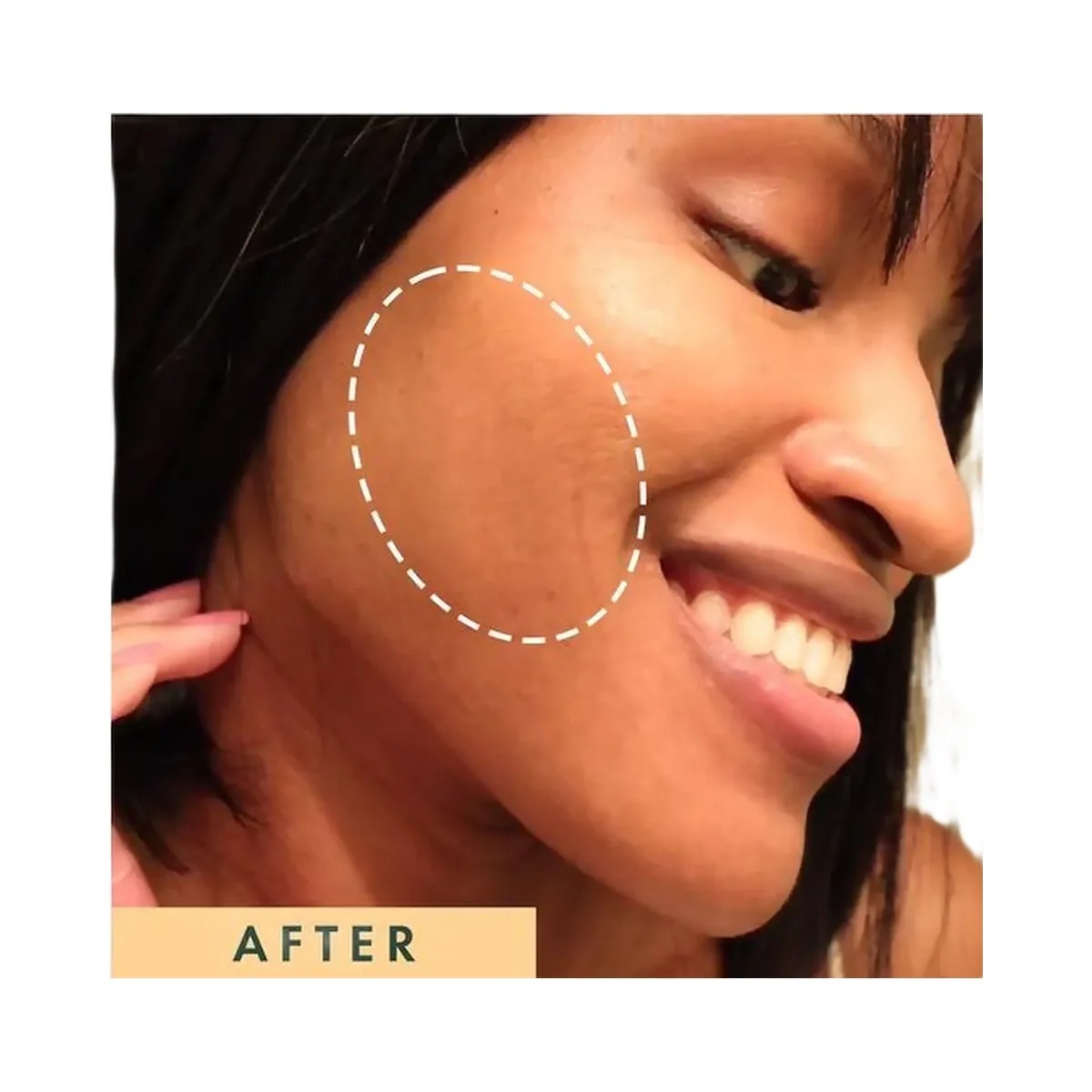 Rael Miracle Clear Brightening Triple Acid Exfoliant - HypeFly India View 4
