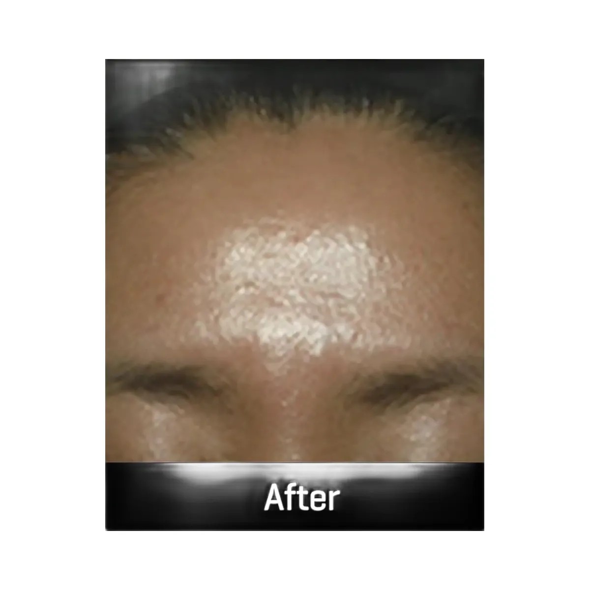 SOME BY MI Galactomyces Pure Vitamin C Glow Serum - HypeFly India View 4